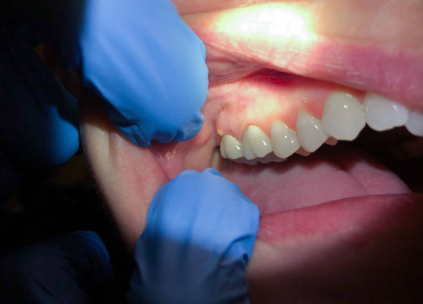Best Emergency Dental Care for Trauma or Injury in Richmond, IN