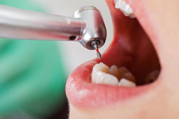 Best Emergency Treatment for Toothache in Richmond, IN